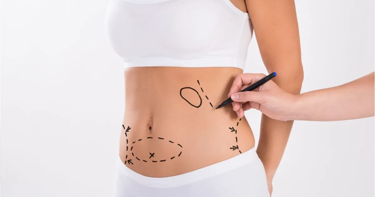 Samsun liposuction